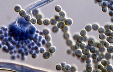 Aspergillus flavus