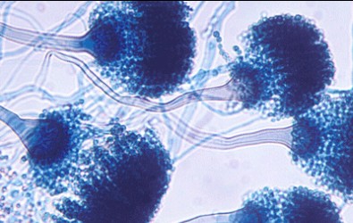 Aspergillus fumigatus