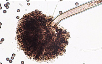 Aspergillus niger